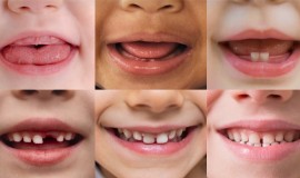 L’ABC della prevenzione si impara in famiglia: i genitori danno il buon esempio ma 7 su 10 non hanno portato i figli dal dentista nell’ultimo anno